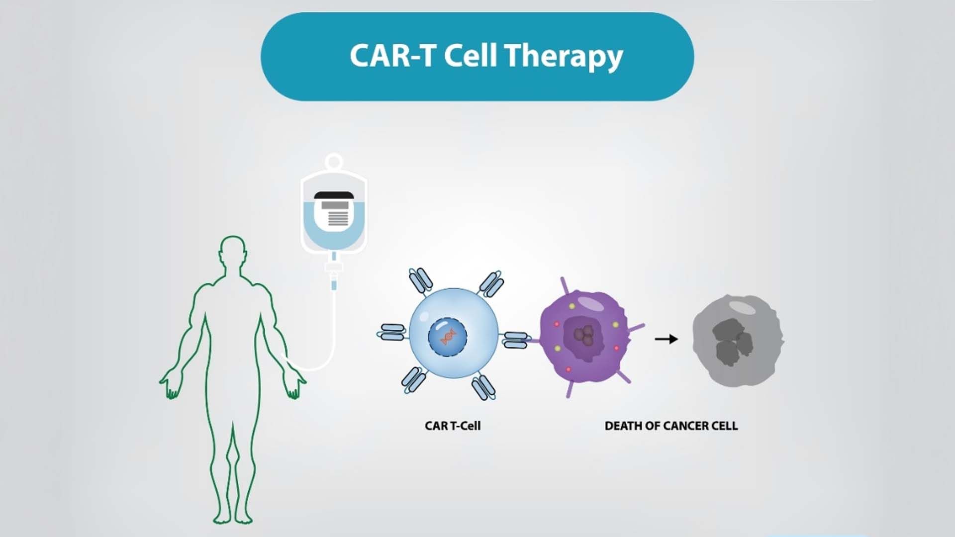 car-t